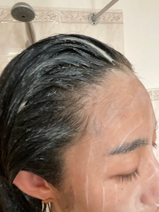 【フェムケア備忘録】憎くてしかたなかった娘たちの湿疹　今は言える、ありがとう愛しています。